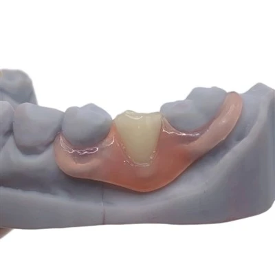 Kev Kho Hniav Nesbit Fexible Denture